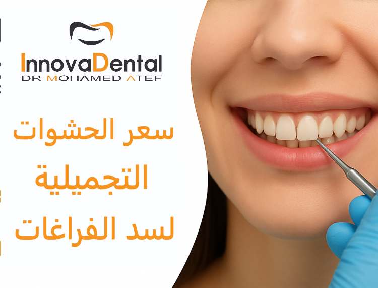 The price of cosmetic fillings to fill gaps